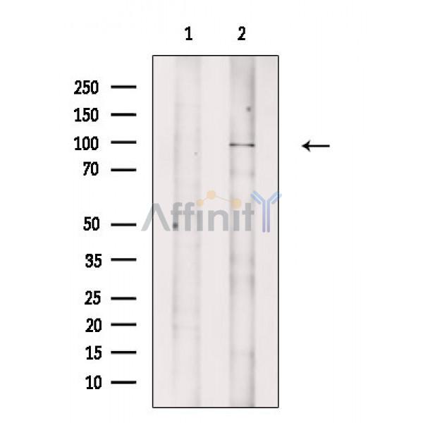 TYRO3 Antibody - Western blot analysis of extracts from Rat heart, using TYRO3 Antibody.