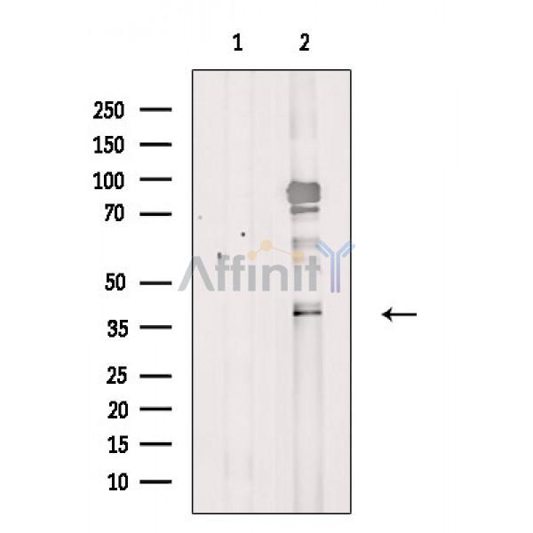 GPR25 Antibody - Western blot analysis of extracts from Rat heart, using GPR25 Antibody.