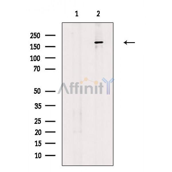 MADD Antibody - Western blot analysis of extracts from A549 cells, using MADD Antibody.