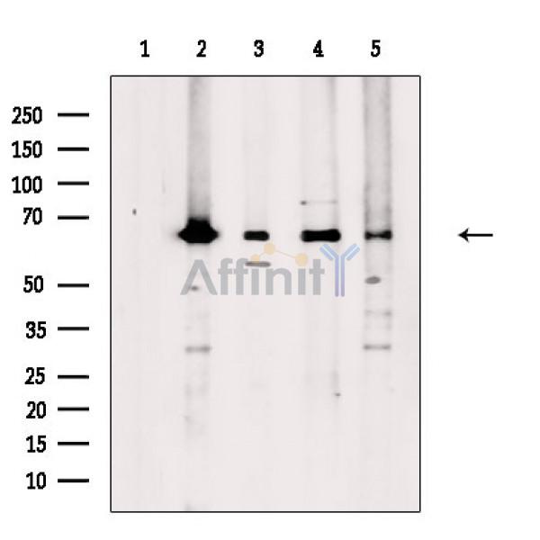 ARFGAP3 Antibody - Western blot analysis of extracts from various samples, using ARFGAP3 Antibody.