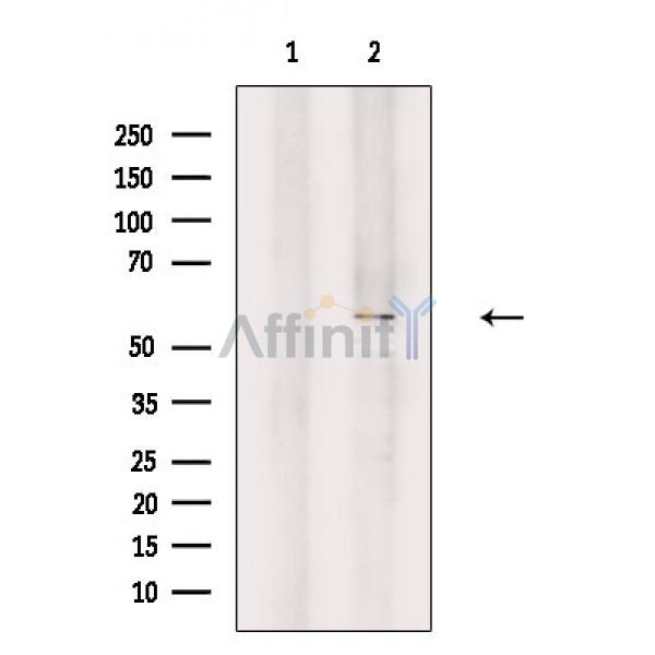 A26B1 Antibody - Western blot analysis of extracts from Rat testis, using A26B1 Antibody.