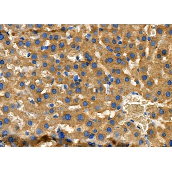 NDRG4 Antibody - DF4341 at 1/100 staining Rat liver tissue by IHC-P.