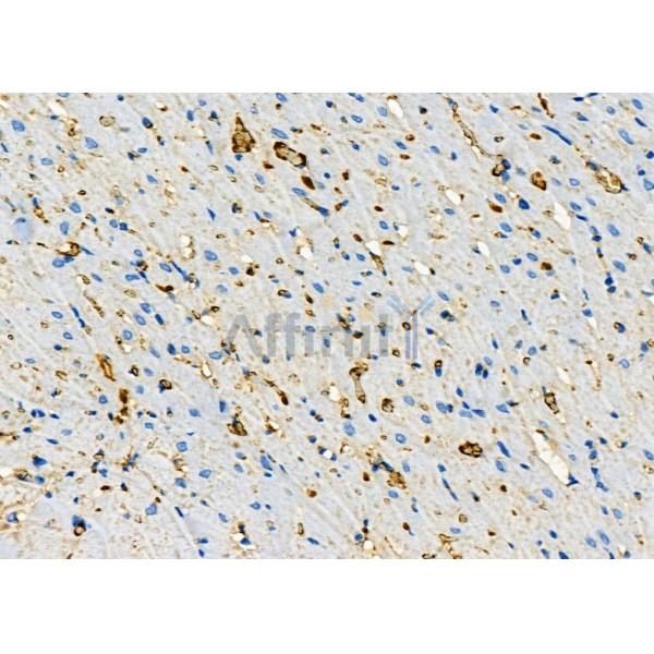 CLTR2 Antibody - DF4917 at 1/100 staining Rat heart tissue by IHC-P.