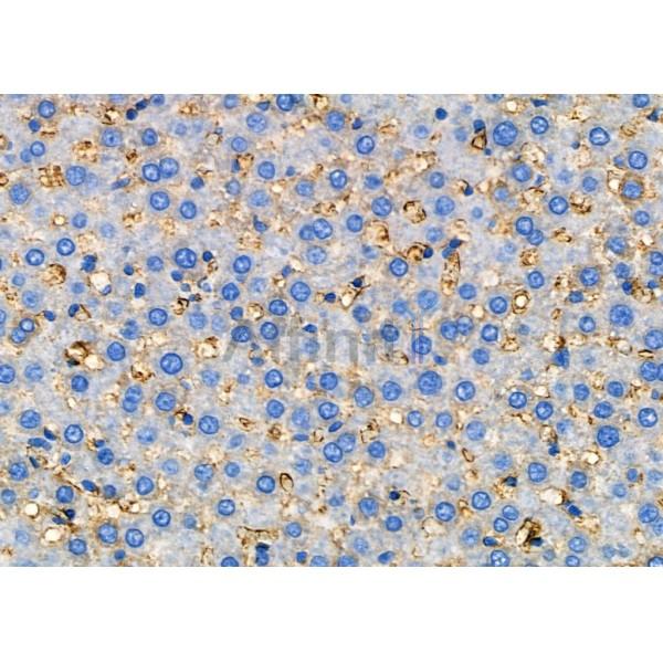 CLTR2 Antibody - DF4917 at 1/100 staining Rat liver tissue by IHC-P.