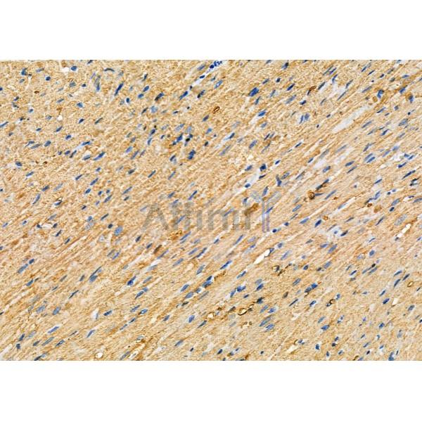 WNK3 Antibody - DF7407 at 1/100 staining Rat heart tissue by IHC-P.