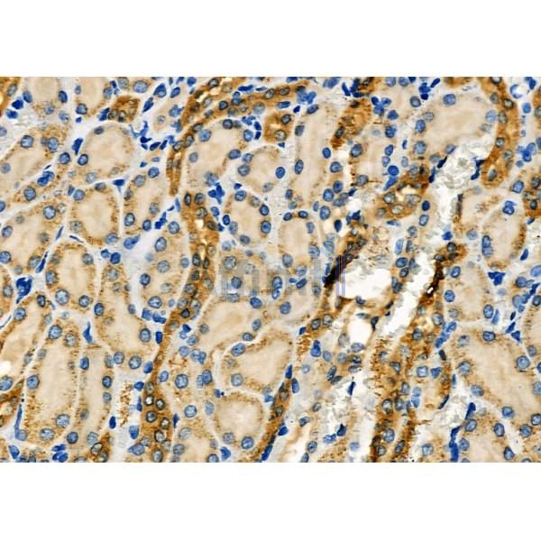 WNK3 Antibody - DF7407 at 1/100 staining Rat kidney tissue by IHC-P.