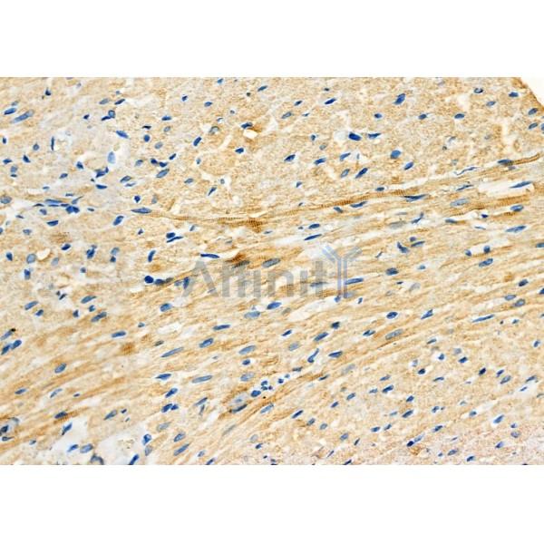 RHOQ Antibody - DF7643 at 1/100 staining Rat heart tissue by IHC-P.
