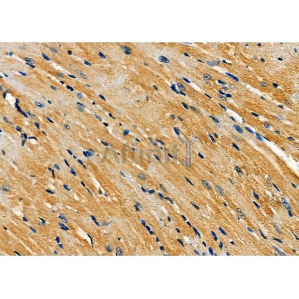 AMFR Antibody - DF7718 at 1/100 staining Mouse heart tissue by IHC-P.
