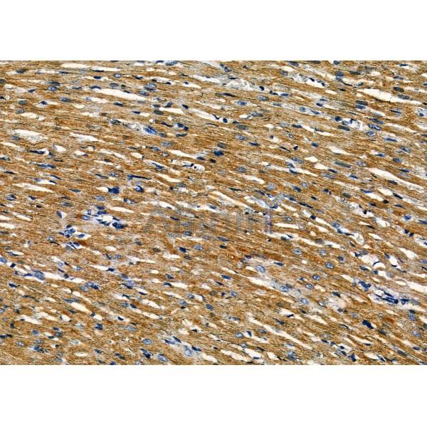 CENPE Antibody - DF7745 at 1/100 staining Rat heart tissue by IHC-P.