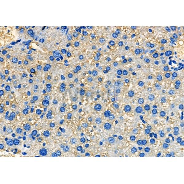 SAA4 Antibody - DF7899 at 1/100 staining Mouse liver tissue by IHC-P.