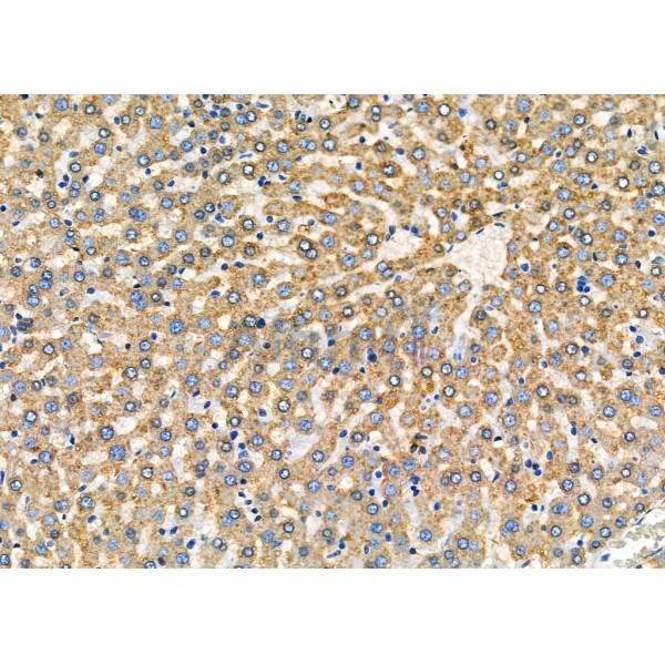 PUM1 Antibody - DF7902 at 1/100 staining Rat liver tissue by IHC-P.