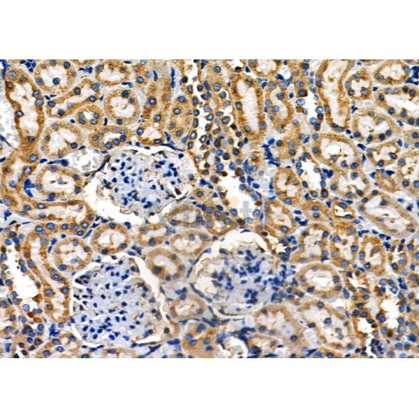 PUM1 Antibody - DF7902 at 1/100 staining Rat kidney tissue by IHC-P.