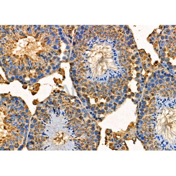 ICAD Antibody - DF7947 at 1/100 staining Mouse testis tissue by IHC-P.