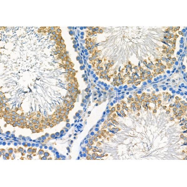 ICAD Antibody - DF7947 at 1/100 staining Rat testis tissue by IHC-P.