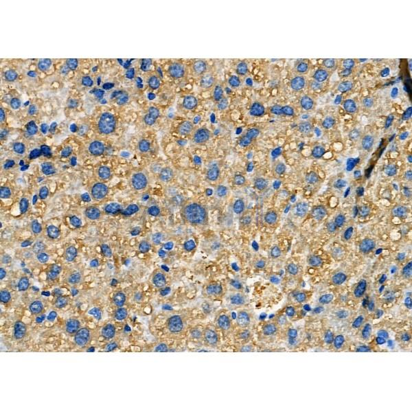 MAP3K15 Antibody - DF8842 at 1/100 staining Mouse liver tissue by IHC-P.