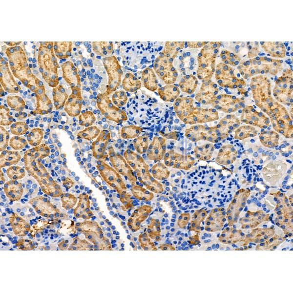 MAP3K15 Antibody - DF8842 at 1/100 staining Rat kidney tissue by IHC-P.