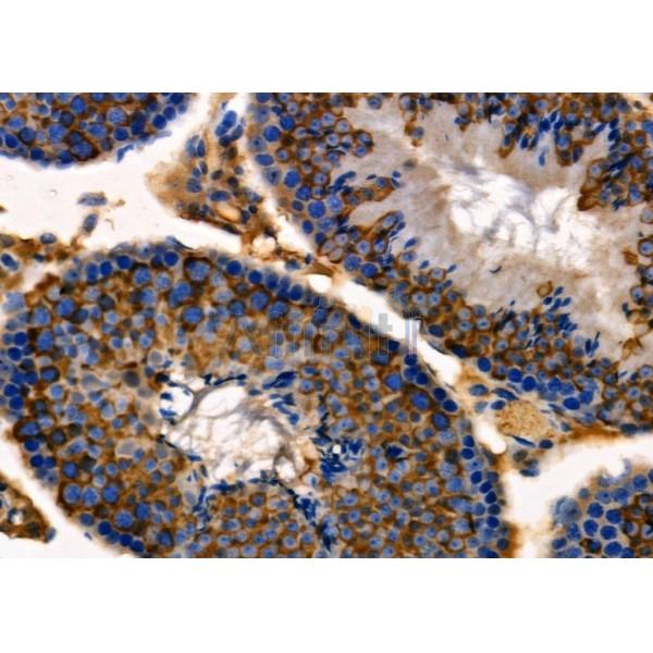 RAB30 Antibody - DF9824 at 1/100 staining Mouse testis tissue by IHC-P.