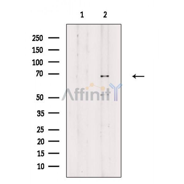 Phospho-YY1 (Ser365) Antibody - Western blot analysis of extracts from Rat heart, using Phospho-YY1 (Ser365) Antibody.