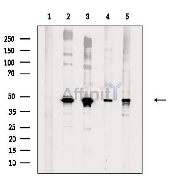Brachyury / Bry Antibody - Western blot analysis of extracts from various samples, using Brachyury / Bry Antibody.