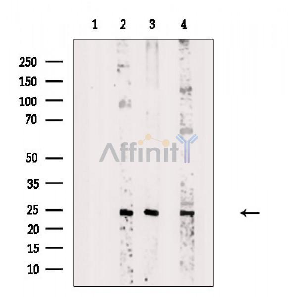 RBPMS Antibody - Western blot analysis of extracts from various samples, using RBPMS Antibody.