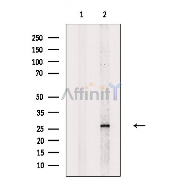 TMEM109 Antibody - Western blot analysis of extracts from Rat kidney, using TMEM109 Antibody.