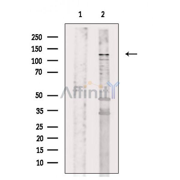 FHOD1 Antibody - Western blot analysis of extracts from Rat liver, using FHOD1 Antibody.