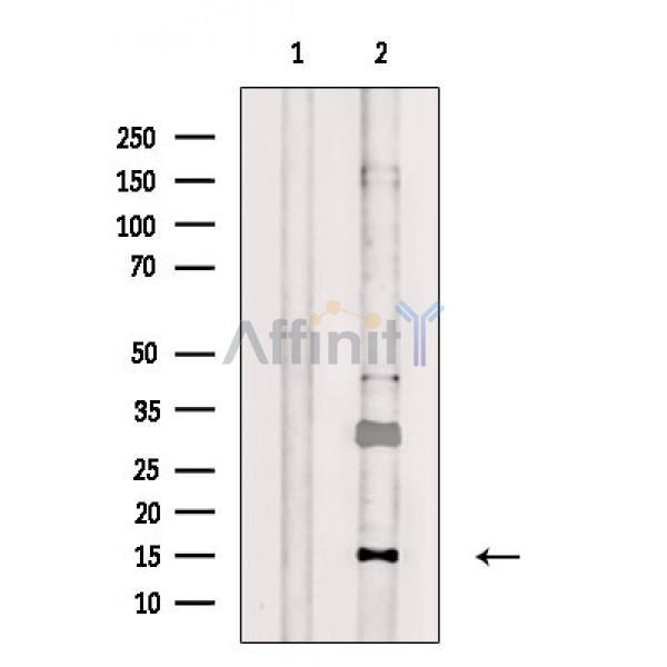 Galectin 1 Antibody - Western blot analysis of extracts from PC12(UV treatment), using Galectin 1 Antibody.