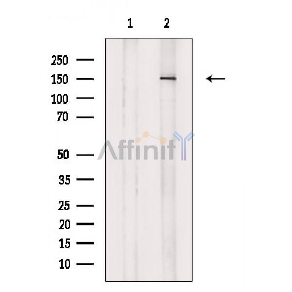 POGZ Antibody - Western blot analysis of extracts from K562 cells(serum starvation treatment), using POGZ Antibody.