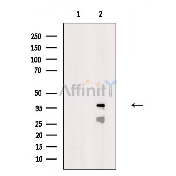 CPXCR1 Antibody - Western blot analysis of extracts from Rat muscle, using CPXCR1 Antibody.