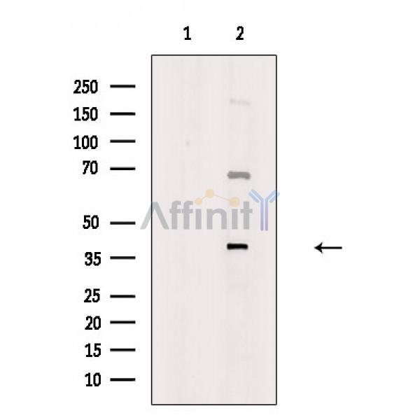 FGF14 Antibody - Western blot analysis of extracts from 293 cells, using FGF14 Antibody.
