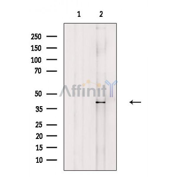 RFC3 Antibody - Western blot analysis of extracts from Hela cells(serum starvation treatment), using RFC3 Antibody.