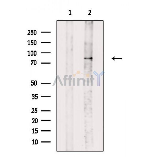 GIT1 Antibody - Western blot analysis of extracts from Mouse brain, using GIT1 Antibody.