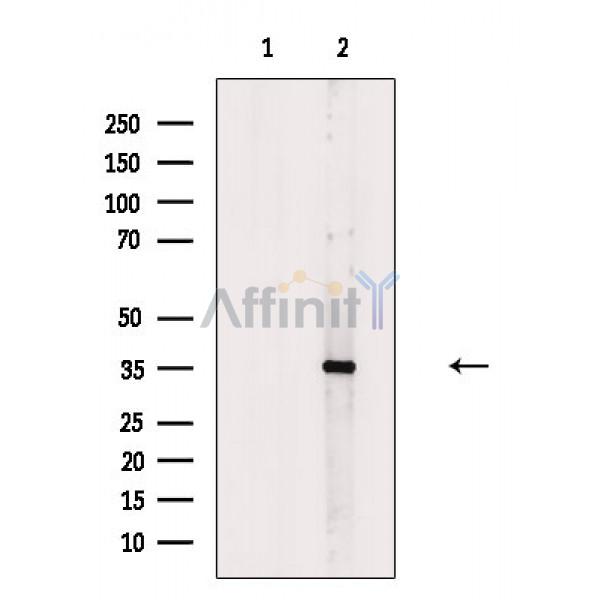 OR2T5/2T29 Antibody - Western blot analysis of extracts from Mouse brain, using OR2T5/2T29 Antibody.