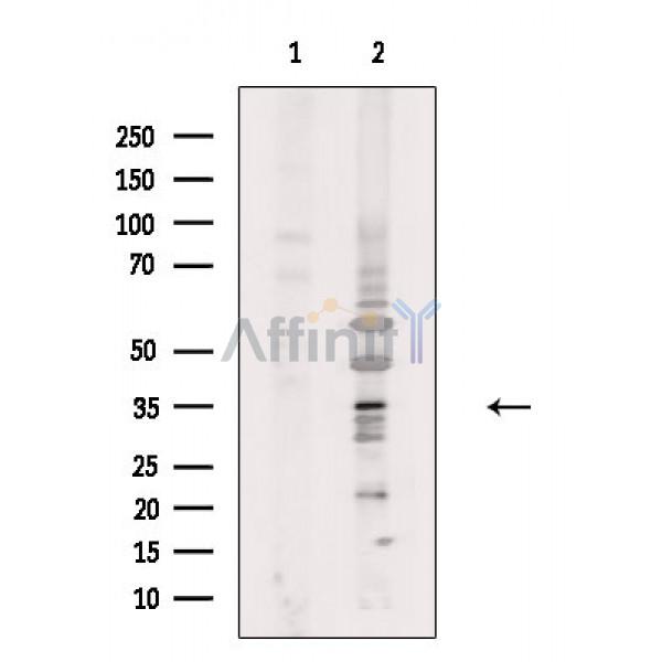 OR4Q3 Antibody - Western blot analysis of extracts from Rat liver, using OR4Q3 Antibody.