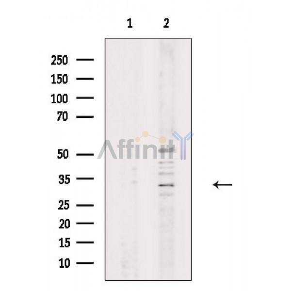 OR51G1 Antibody - Western blot analysis of extracts from Rat liver, using OR51G1 Antibody.
