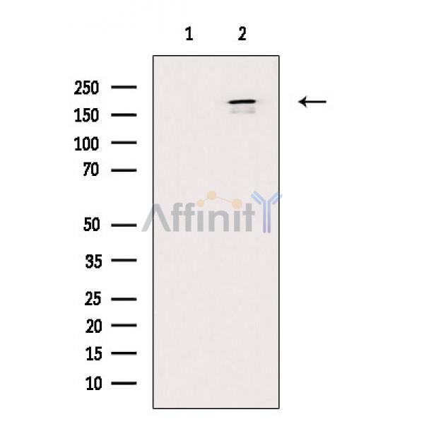 AKAP12 Antibody - Western blot analysis of extracts from K562 cells(serum starvation treatment), using AKAP12 Antibody.