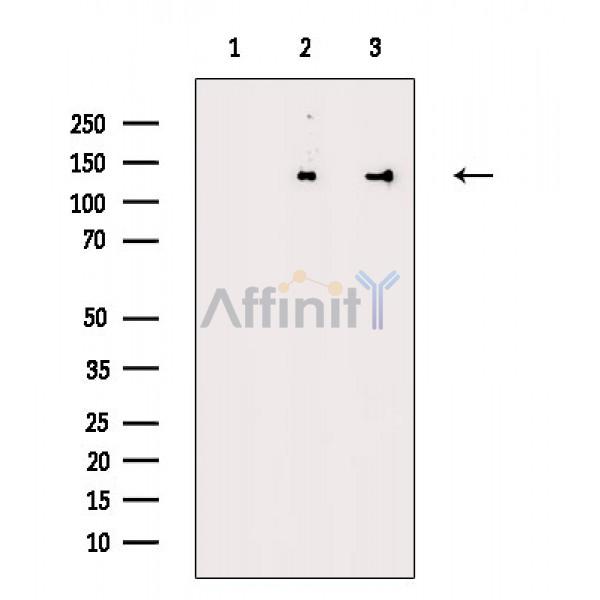 SART3 Antibody - Western blot analysis of extracts from various samples, using SART3 Antibody.