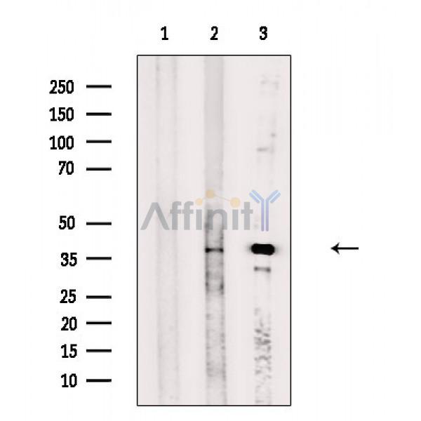 DHRS7 Antibody - Western blot analysis of extracts from various samples, using DHRS7 Antibody.