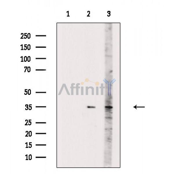 PLSCR1 Antibody - Western blot analysis of extracts from various samples, using PLSCR1 Antibody.