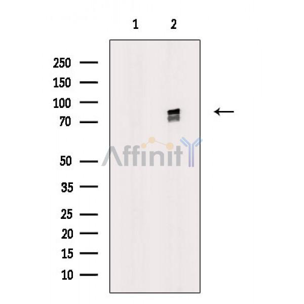 beta Catenin Antibody - Western blot analysis of extracts from Rat liver, using beta Catenin Antibody.
