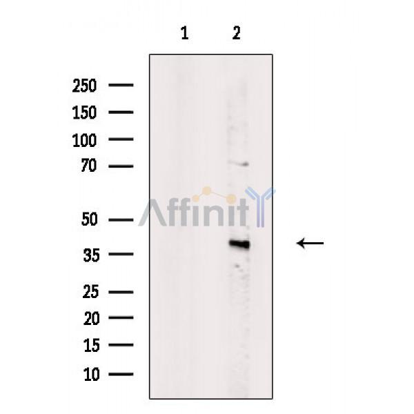 TIMM50 Antibody - Western blot analysis of extracts from Raji cells(UV treatment), using TIMM50 Antibody.