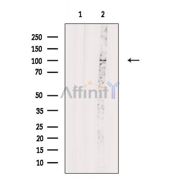 DDR2 Antibody - Western blot analysis of extracts from 3T3-L1 cells, using DDR2 Antibody.