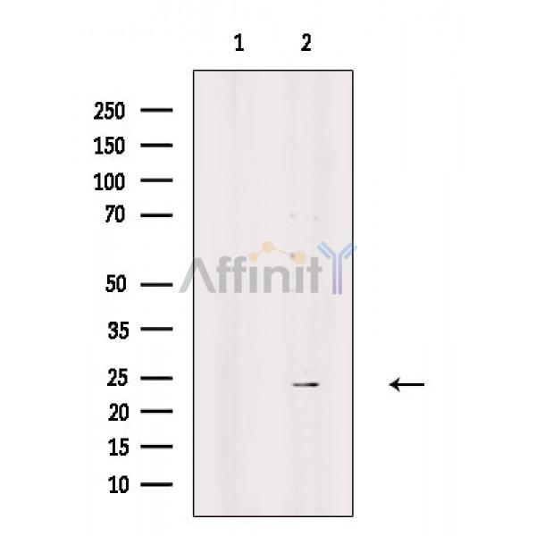 SRY Antibody - Western blot analysis of extracts from Rat liver, using SRY Antibody.