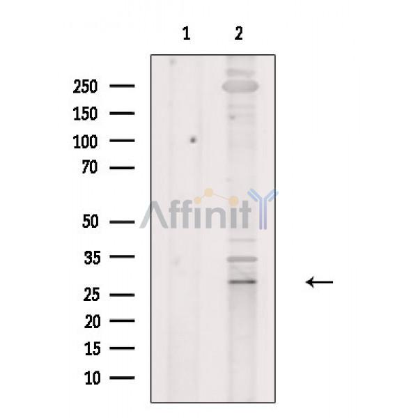 LFA3 Antibody - Western blot analysis of extracts from Mouse brain, using LFA3 Antibody.