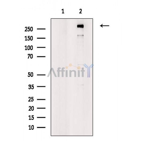 MEGF8 Antibody - Western blot analysis of extracts from Mouse brain, using MEGF8 Antibody.