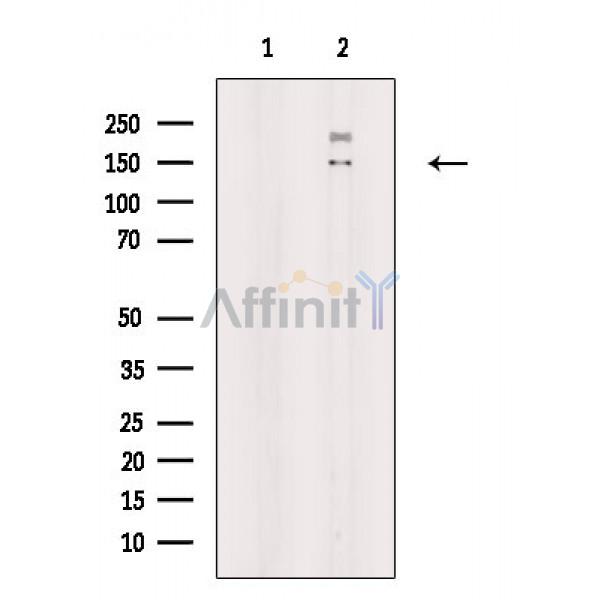 MYBBP1A Antibody - Western blot analysis of extracts from Hela cells(heat shock treatment), using MYBBP1A Antibody.