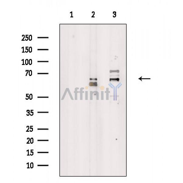 PDLIM5 Antibody - Western blot analysis of extracts from various samples, using PDLIM5 Antibody.
