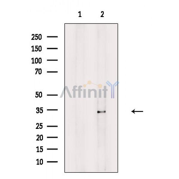 Sarcoglycan beta Antibody - Western blot analysis of extracts from Rat brain, using Sarcoglycan beta Antibody.