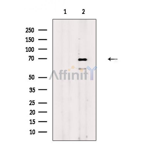 FOXN1 Antibody - Western blot analysis of extracts from Rat brain, using FOXN1 Antibody.