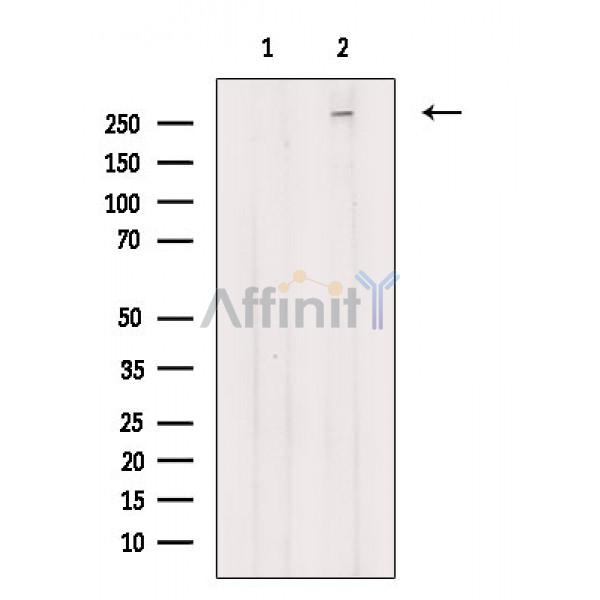 NAV3 Antibody - Western blot analysis of extracts from Hela cells(heat shock treatment), using NAV3 Antibody.
